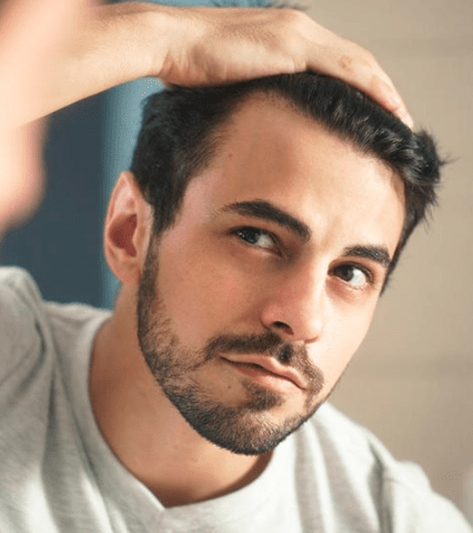 Understanding Men’s Hair Loss_ All You Need to Know about the Norwood Scale