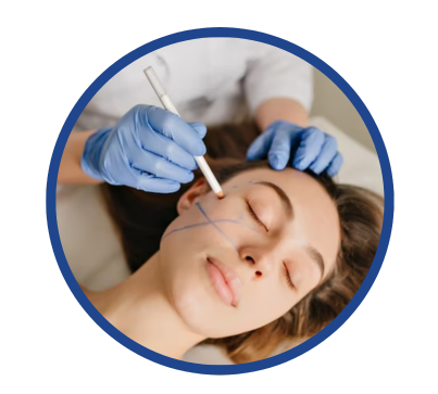 cosmotology - Microneedling