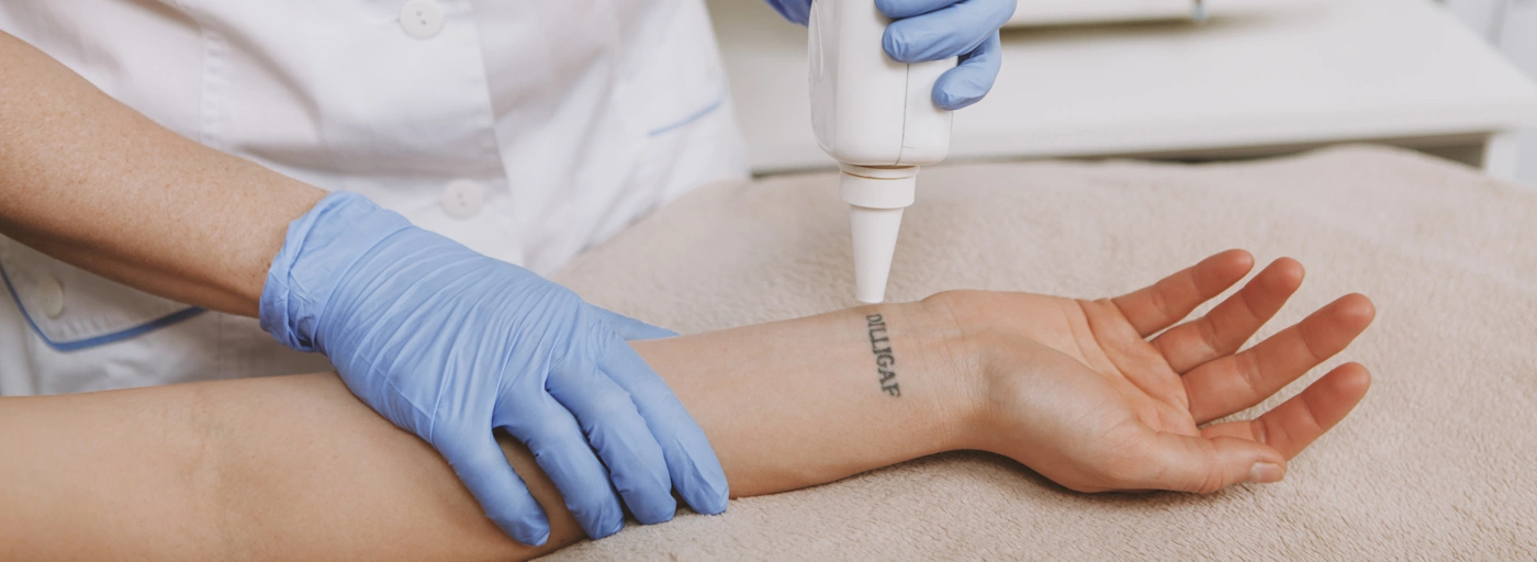 laser tattoo removal treatment in thane