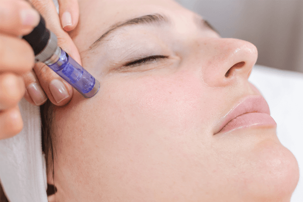 microneedling treatment in thane